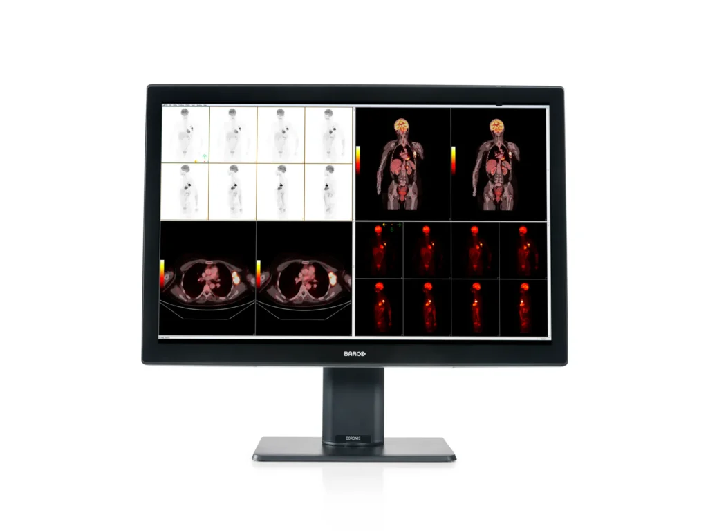 Coronis Fusion 6MP MDCC-6530 Barco