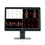 Coronis Fusion 6MP (MDCC-6530) 4 Coronis Fusion 6MP MDCC-6530 Barco