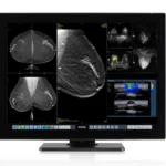 Coronis OneLook (MDMC‑32133) 3 Coronis OneLook MDMC-32133