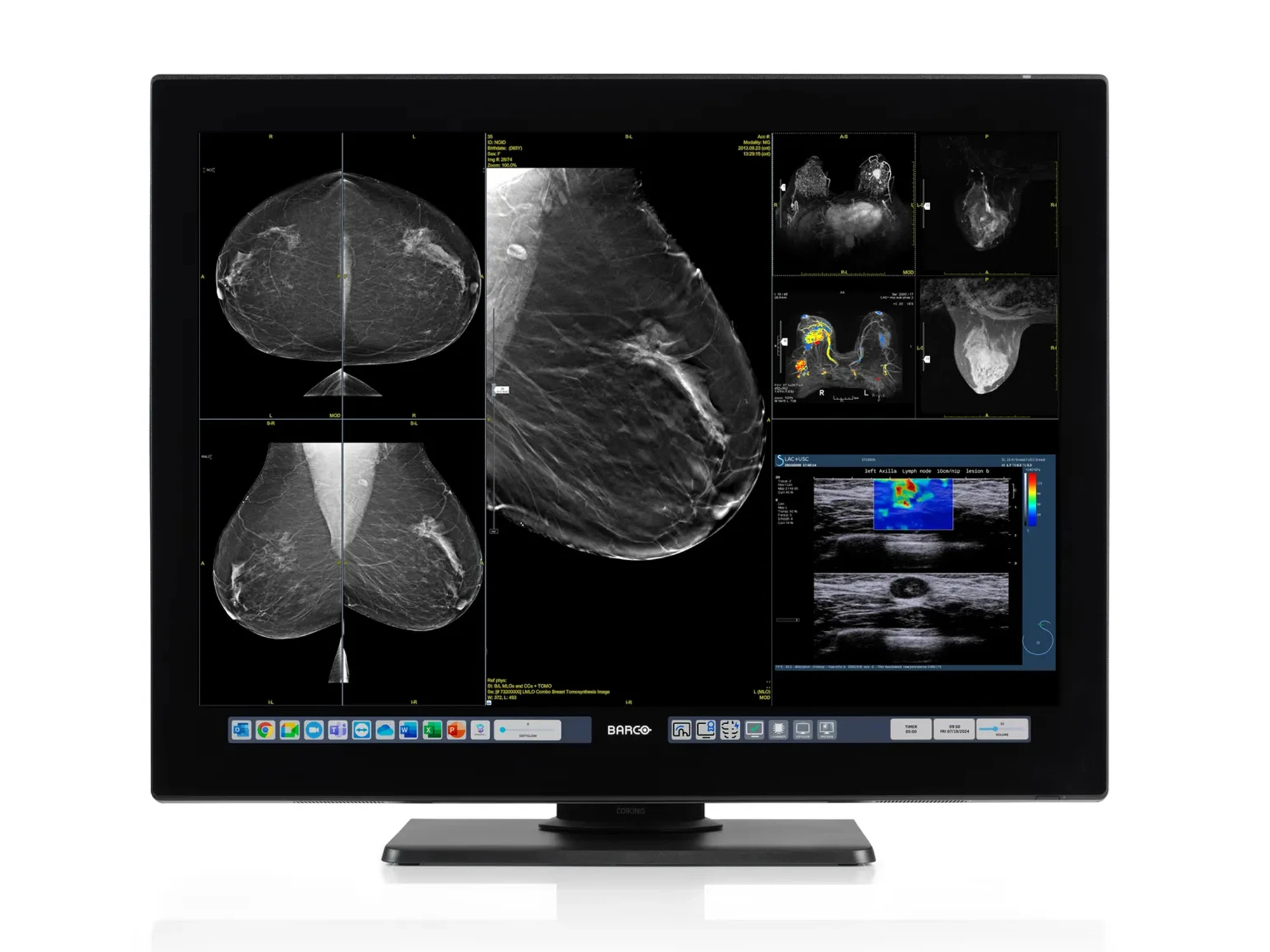 Coronis OneLook MDMC-32133 Coronis OneLook MDMC-32133