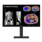 LG 27HS713C-B 1 Monitor LG 27hs713c 8mp