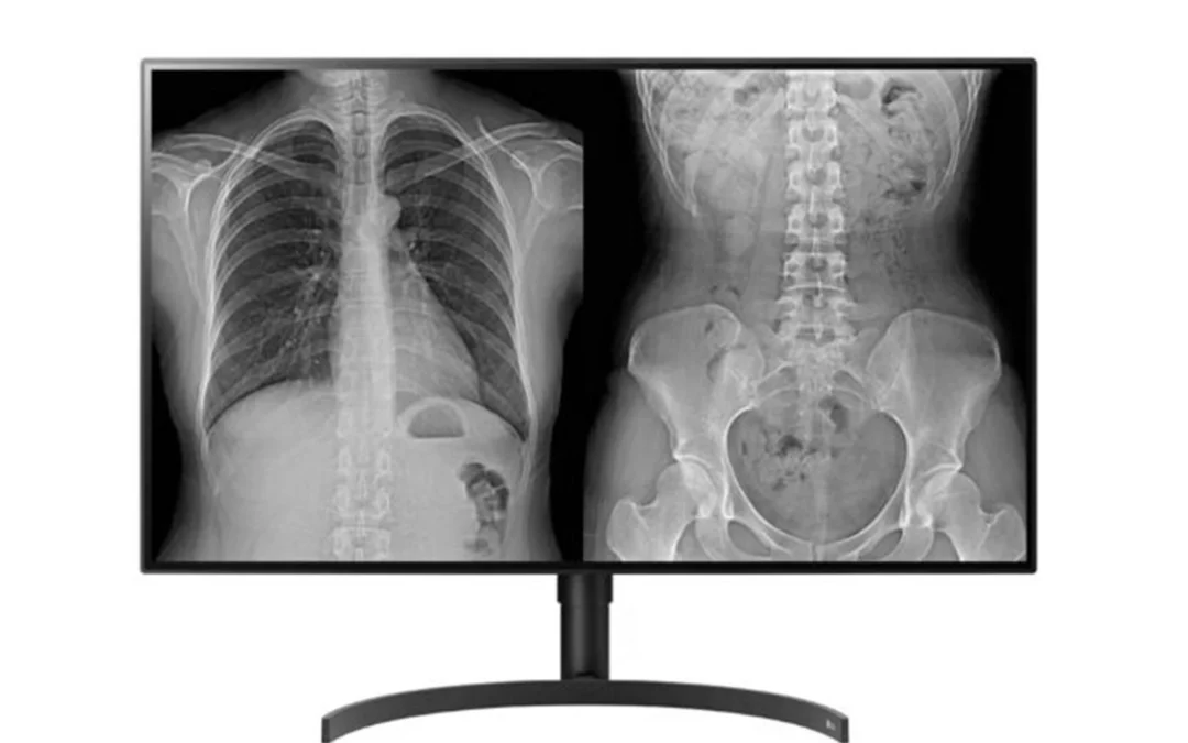 LG 32HL512D-B