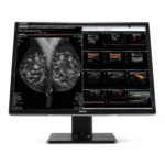 Nio Fusion 12MP (MDNC-12130) 1 Nio Fusion MDMC 12130