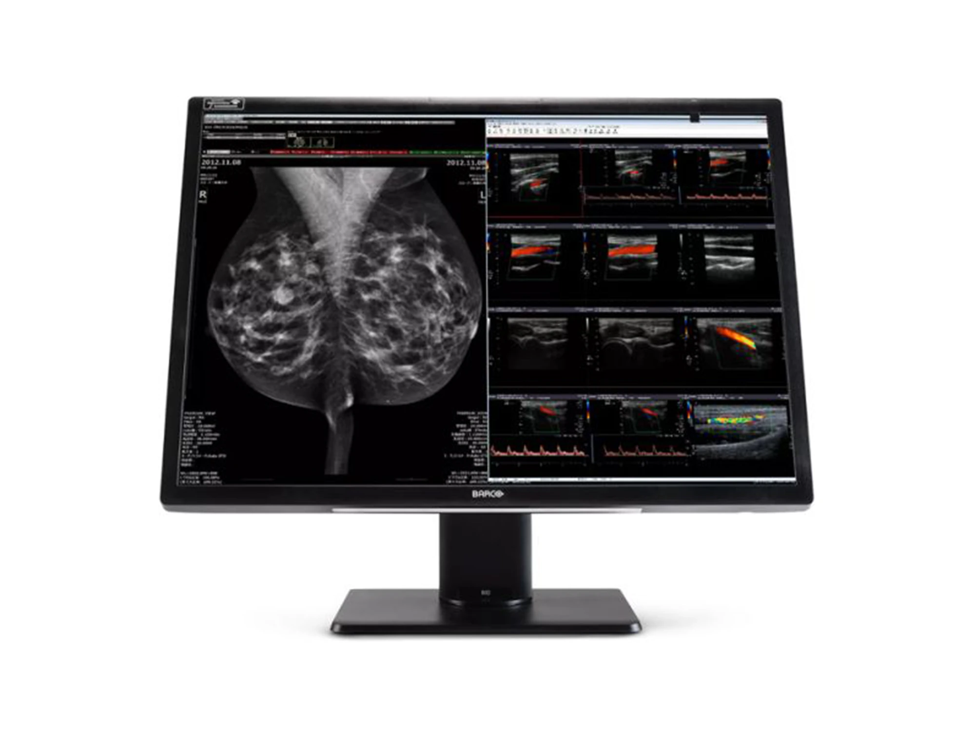 Nio Fusion MDMC 12130